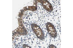 Immunohistochemical staining of human colon with TJP2 polyclonal antibody  shows moderate cytoplasmic and membranous positivity in glandular cells at 1:50-1:200 dilution. (TJP2 抗体)