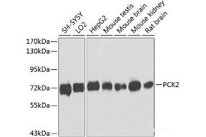 Western blot analysis of extracts of various cell lines using PCK2 Polyclonal Antibody at dilution of 1:1000. (PEPCK 抗体)