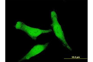 Immunofluorescence of monoclonal antibody to SMAD7 on HeLa cell. (SMAD7 抗体  (AA 160-260))