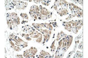 Immunohistochemistry (IHC) image for anti-Carbohydrate (Keratan Sulfate Gal-6) Sulfotransferase 1 (CHST1) (N-Term) antibody (ABIN2782241) (CHST1 抗体  (N-Term))