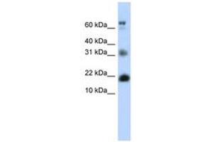 Image no. 1 for anti-BUD31 Homolog (BUD31) (N-Term) antibody (ABIN6740544)