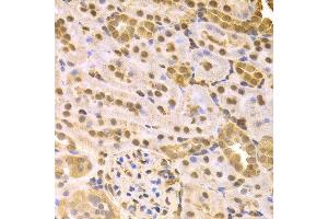 Immunohistochemistry (IHC) image for anti-Mitogen-Activated Protein Kinase Kinase 7 (MAP2K7) (AA 1-250) antibody (ABIN3023157) (MAP2K7 抗体  (AA 1-250))