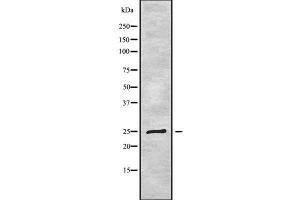 Western blot analysis of LYPLA2 using COLO205 whole cell lysates (LYPLA2 抗体  (C-Term))
