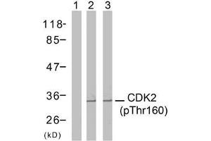 Western blot analysis of extracts from A2780 cells (Lane 1 and 2) and MDA-MB-435 cells (Lane 3), using CDK2 (phospho-Thr160) antibody (E011133). (CDK2 抗体  (pThr160))