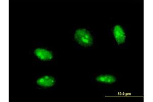 Immunofluorescence of monoclonal antibody to NANOG on HeLa cell. (Nanog 抗体  (AA 98-195))