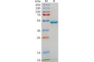 Human IL18 Protein, hFc Tag on SDS-PAGE under reducing condition. (IL-18 Protein (Fc Tag))