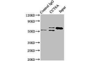 Immunoprecipitating CCT6A in Hela whole cell lysate Lane 1: Rabbit control IgG instead of ABIN7171432 in Hela whole cell lysate. (CCT6A 抗体  (AA 80-250))