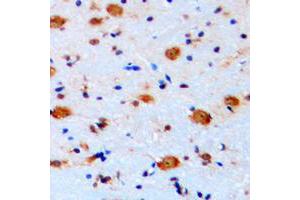 Immunohistochemical analysis of ARHGAP22 staining in human brain formalin fixed paraffin embedded tissue section. (ARHGAP22 抗体  (C-Term))