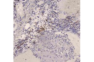 IHC analysis of DC-SIGN using anti-DC-SIGN antibody . (DC-SIGN/CD209 抗体)