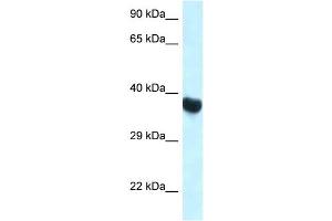 WB Suggested Anti-Hoxa10 Antibody Titration: 1. (HOXA10 抗体  (C-Term))