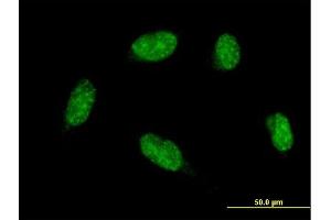 Immunofluorescence of monoclonal antibody to ATOH1 on HeLa cell. (ATOH1 抗体  (AA 266-354))