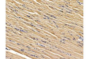 ABIN7096174 and ABIN7100236 at 1/100 staining rat muscle tissue by IHC-P. (KIAA0319 抗体)