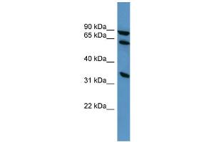 WB Suggested Anti-ELMO1 Antibody Titration: 0. (ELMO1 抗体  (C-Term))