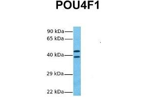 Host:  Rabbit  Target Name:  POU4F1  Sample Tissue:  Human Fetal Lung  Antibody Dilution:  1.