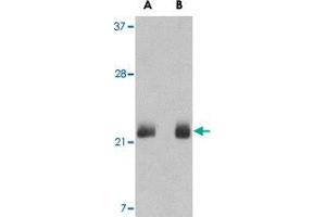 Western blot analysis of FGF4 in NIH NIH/3T3 cell lysate with FGF4 polyclonal antibody  at (A) 0. (FGF4 抗体  (C-Term))