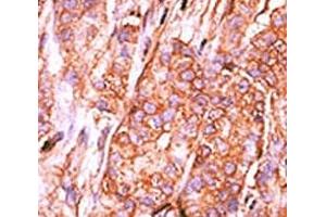 Immunohistochemistry (IHC) image for anti-CTD (Carboxy-terminal Domain, RNA Polymerase II, Polypeptide A) Small Phosphatase 2 (CTDSP2) (AA 12-42) antibody (ABIN3030574)