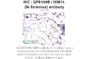 Image no. 2 for anti-Hydroxycarboxylic Acid Receptor 3 (HCAR3) (Extracellular Domain), (N-Term) antibody (ABIN1734901) (GPR109B 抗体  (Extracellular Domain, N-Term))