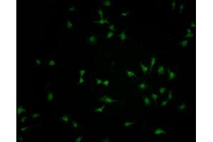 Immunofluorescence staining of SH-SY5Y cells with ABIN7152433 at 1:100, counter-stained with DAPI. (FBXO36 抗体  (AA 1-188))