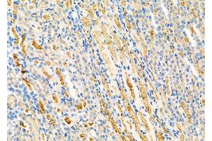 ABIN6264562 and ABIN6279729 at 1/100 staining Rat kidney tissue by IHC-P. (RAB1B 抗体  (Internal Region))