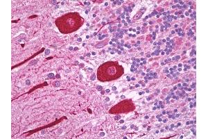 Anti-Alpha Tubulin antibody IHC of human brain, cerebellum, Purkinje cells.