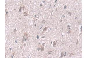 Immunohistochemistry (IHC) image for anti-Exosome Component 2 (EXOSC2) (AA 1-293) antibody (ABIN7441514)