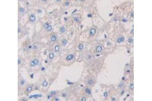 IHC-P analysis of Human Tissue, with DAB staining. (TRPA1 抗体  (AA 63-370))
