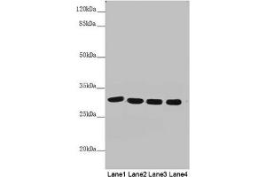Western blot All lanes: MTX2 antibody at 4. (MTX2 抗体  (AA 1-263))