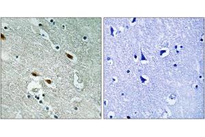 Immunohistochemistry analysis of paraffin-embedded human brain tissue using 53BP1 antibody. (TP53BP1 抗体)