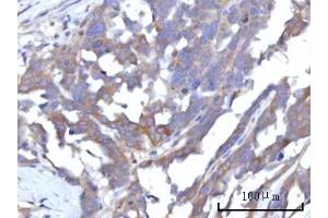 IHC analysis of RAP1GAP using anti-RAP1GAP antibody (ABIN7599729). (RAP1GAP 抗体  (AA 11-661))
