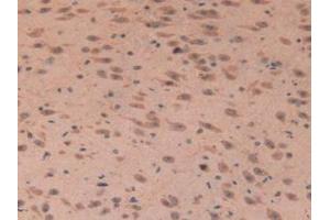 IHC-P analysis of Mouse Brain Tissue, with DAB staining. (IGFBP7 抗体  (AA 88-281))