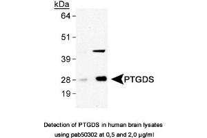 Image no. 1 for anti-Prostaglandin D2 Synthase (PTGDS) antibody (ABIN363611) (PTGDS 抗体)