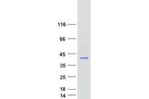 Western Blotting (WB) image for Ras-Related GTP Binding B (RRAGB) protein (Myc-DYKDDDDK Tag) (ABIN2731192)