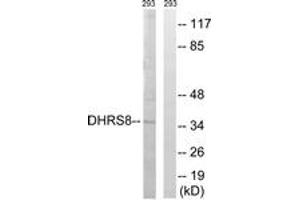 Western blot analysis of extracts from 293 cells, using DHRS8 Antibody. (HSD17B11 抗体  (AA 71-120))