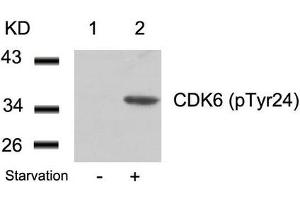 Western blot analysis of extracts from 293 cells untreated(lane 1) or treated with starvation(lane 2) using CDK6(phospho-Tyr24) Antibody. (CDK6 抗体  (pTyr24))