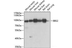 Western blot analysis of extracts of various cell lines using BBS2 Polyclonal Antibody at dilution of 1:1000. (BBS2 抗体)