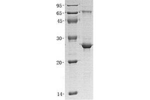 Western Blotting (WB) image for Protein Phosphatase, Mg2+/Mn2+ Dependent, 1G (PPM1G) (Transcript Variant 1) protein (His tag) (ABIN2729811)