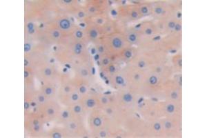 Used in DAB staining on fromalin fixed paraffin- embedded liver tissue (Biliverdin Reductase 抗体  (AA 1-125))