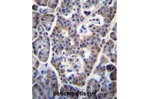 TP53INP1 Antibody (C-term) immunohistochemistry analysis in formalin fixed and paraffin embedded human pancreas tissue followed by peroxidase conjugation of the secondary antibody and DAB staining. (TP53INP1 抗体  (C-Term))