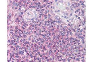 Anti-IRAK4 antibody IHC of human spleen. (IRAK4 抗体  (C-Term))