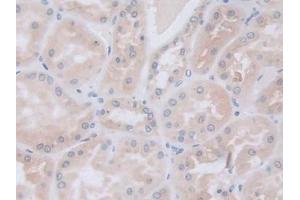 Detection of GLa in Human Kidney Tissue using Polyclonal Antibody to Galactosidase Alpha (GLa) (GLA 抗体  (AA 81-429))