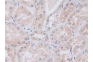 Detection of GLa in Human Kidney Tissue using Polyclonal Antibody to Galactosidase Alpha (GLa) (GLA 抗体  (AA 81-429))