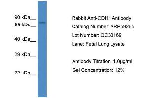 WB Suggested Anti-CDH1  Antibody Titration: 0. (E-cadherin 抗体  (Middle Region))