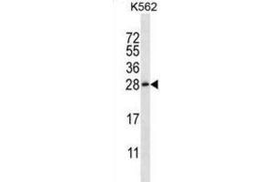 Western Blotting (WB) image for anti-Chorionic Somatomammotropin Hormone-Like 1 (CSHL1) antibody (ABIN2997108) (CSHL1 抗体)