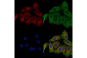 ABIN6257094 and ABIN6275278 staining Hela cells by IF/ICC.