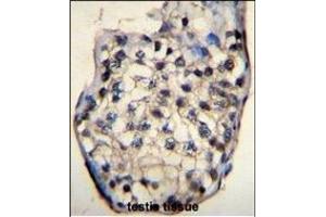Immunohistochemistry (Paraffin-embedded Sections) (IHC (p)) image for anti-Outer Dense Fiber of Sperm Tails 3 (ODF3) (AA 170-199), (C-Term) antibody (ABIN655745)