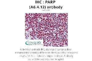 Image no. 3 for anti-Poly (ADP-Ribose) Polymerase 1 (PARP1) antibody (ABIN1723251) (PARP1 抗体)