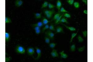 Immunofluorescence staining of A549 cells with ABIN7166440 at 1:100, counter-stained with DAPI. (PORCN 抗体  (AA 269-332))