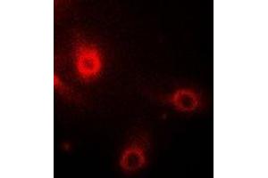 Immunofluorescent analysis of Aminoacylase 1 staining in Hela cells. (Aminoacylase 1 抗体)