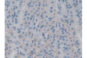 Immunohistochemistry (IHC) image for anti-Transient Receptor Potential Cation Channel, Subfamily M, Member 7 (TRPM7) (AA 19-179) antibody (ABIN7436144)