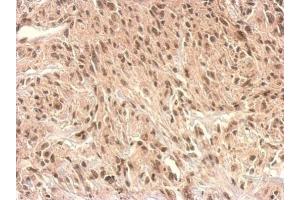 Immunohistochemistry (IHC) image for anti-Monoglyceride Lipase (MGLL) antibody (ABIN2855646)